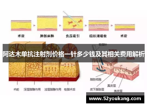 阿达木单抗注射剂价格一针多少钱及其相关费用解析